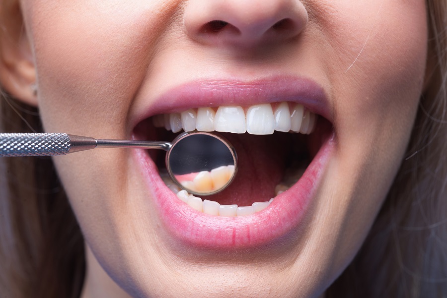 5 Most Common Cosmetic Dentistry Services